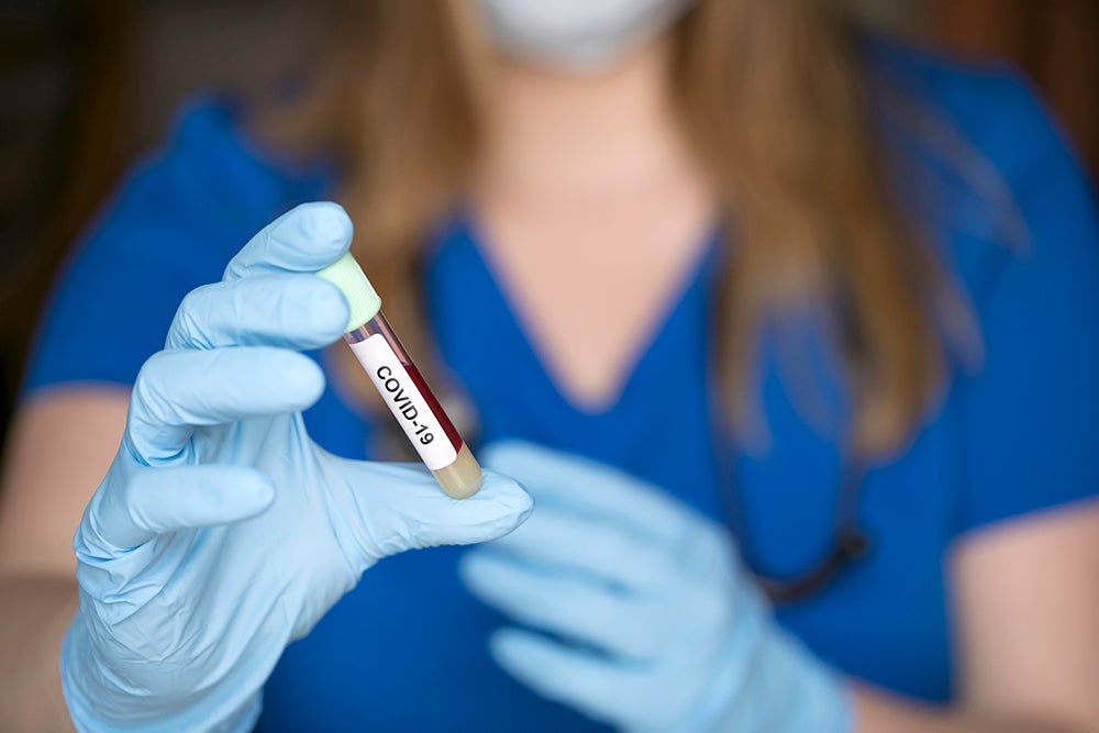 المؤشرات الحيوية التشخيصية لفيروس كورونا والعلاجات المضادة للفيروسات