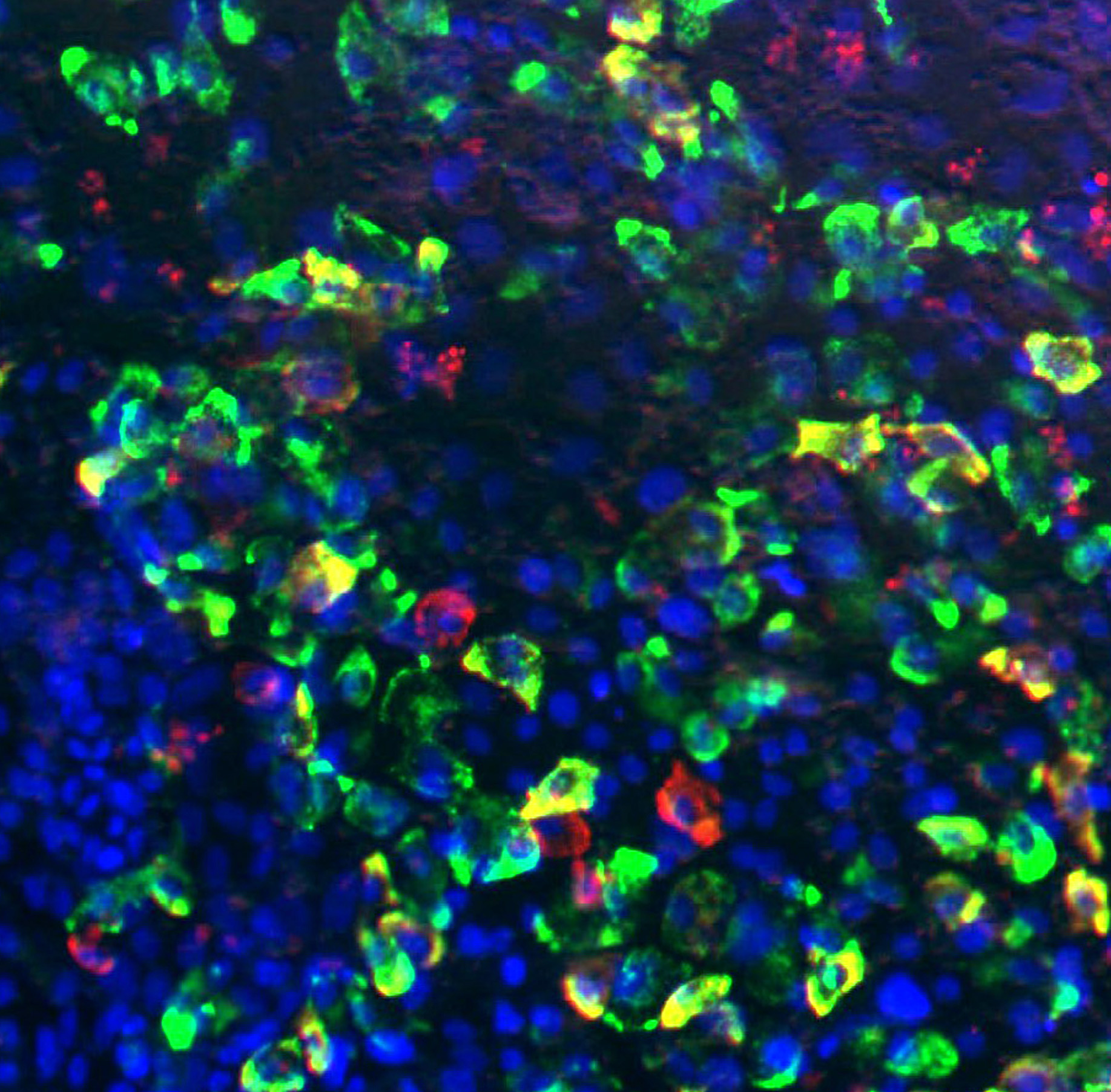 الشكل (2): صورة تم الحصول عليها باستخدام مجهر فلوري تظهر إنتاج خلايا تشبه الجزيرة من الخلايا الجذعية المحفزة (خضراء: إنسولين؛ حمراء: جلوكاجون؛ زرقاء: دابي، وهي وصمة فلورسنت فلورية ترتبط بقوة بالحمض النووي بالنيكليوتيدات الذي يلوث نوى الخلايا).