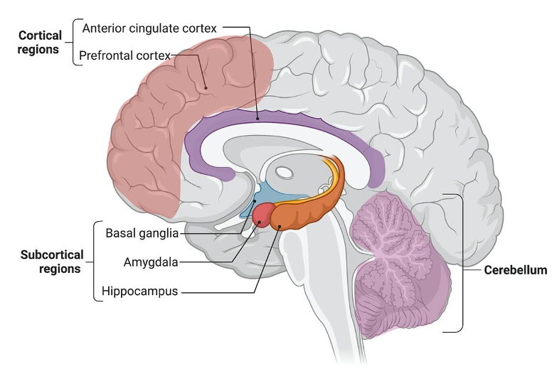 الشكل (2): مناطق الدماغ الثلاثة المرتبطة باضطراب فرط النشاط ونقص الانتباه 