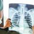 CSE’s research study seeks to advance drug therapy for tuberculosis