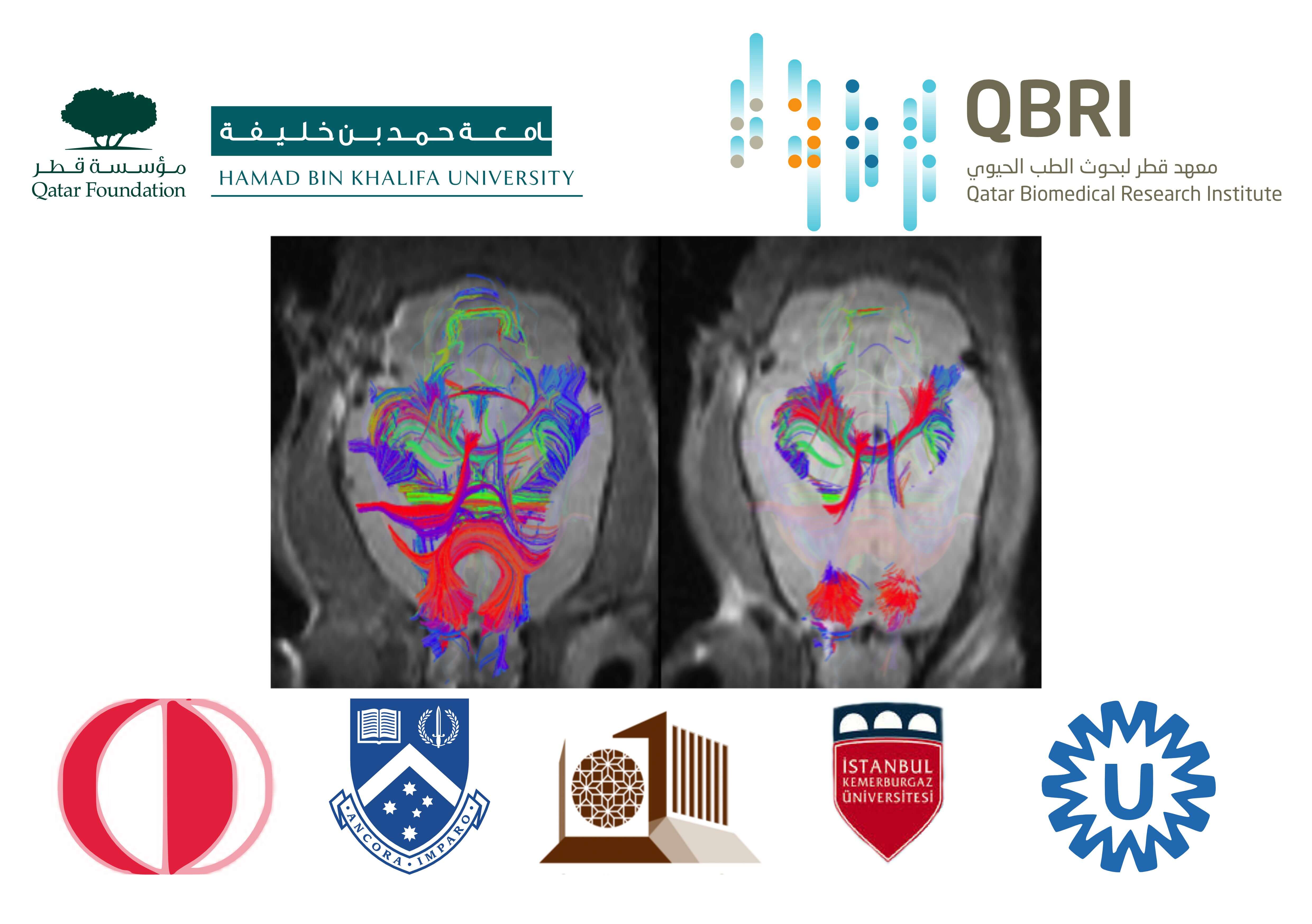 معهد بحثي تابع لجامعة حمد بن خليفة يُقود تعاونًا بحثيًّا رائدًا حول إصابات الدماغ الرضِّيَّة بمنحة من الصندوق القطري لرعاية البحث العلمي